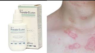 Allergy Eczematreatment in urduProvate S lotion Uses benefits and disadvanteges in urdu [upl. by Atirahs744]