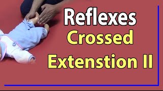 04 Crossed Extension Reflex II [upl. by Leila305]