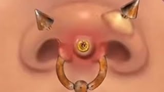 Nose cleaningnose ring cleaningpimple extraction trending animation satisfying asmr [upl. by Neelloc371]