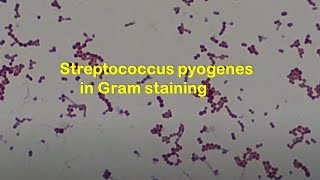 Streptococcus pyogenes in Gram staining [upl. by Hbaruas]