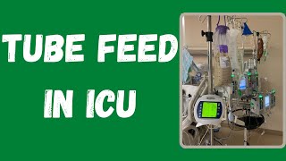 Nutrition in critically ill patients a comprehensive guide [upl. by Llerrom127]