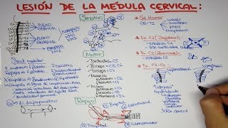 Lesión de la médula cervical  trauma vertebro medular [upl. by Moises]