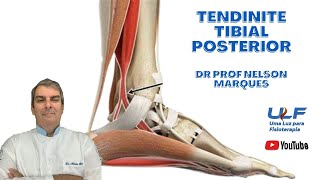 TENDINITE  TIBIAL POSTERIOR  Dr Prof Nelson Marques [upl. by Ellehcer428]