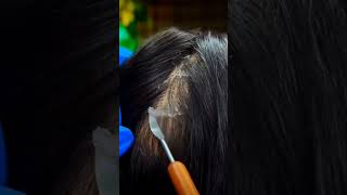 ASMR Satisfying Dandruff Removal you will feel sleepy 😴😴 [upl. by Odraboel]