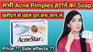 Acnestar soap Review  Acnestar Soap for Acne Pimples  Detailed review Uses Benefits [upl. by Aurelius575]