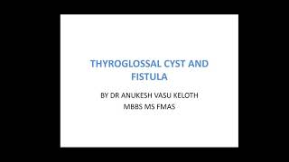 Thyroglossal cyst amp fistula [upl. by Featherstone]