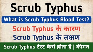 Scrub Typhus Test in hindi  Causes amp Symptoms of Scrub Typhus [upl. by Annoeik390]