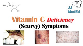 Vitamin C Deficiency Scurvy Symptoms ex bad teeth fatigue Why symptoms happen amp who gets them [upl. by Trellas]