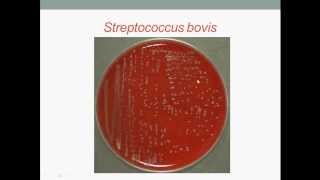 Bacteriology Streptococcus Gram Positive Cocci [upl. by Ricki]