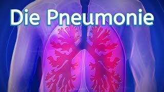 Die Pneumonie [upl. by Anitnatsnok]