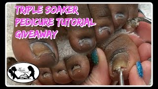 Pedicure Tutorial Excessive Buildup Removal Toenail Cleaning 😎 [upl. by Settera]