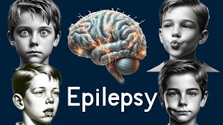 Epilepsy in Children  Simply Explained [upl. by Eatnoj]