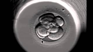 ivf embryo developing over 5 days by fertility Dr Raewyn Teirney [upl. by Eniahpets]