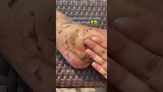 Deep Cleansing Remove Dust and Dead Skin ameenbeautytips GlowAndCleanByAmeen [upl. by Platon]