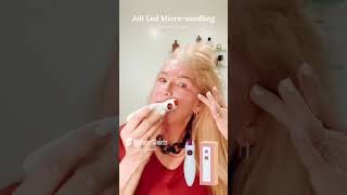 Microneedling amp Hexapeptide8 Your AntiAging Duo antiagingtreatment antiagingskincare aging [upl. by Petigny973]