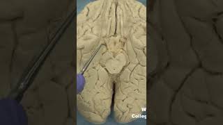 Medial temporal lobe parahippocampal gyrus neuroanatomy temporallobecortexlimbic system [upl. by Parsifal]