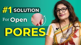 How to treat OPEN PORES  Enlarged Pores  Causes amp Treatment  Natural Skincare Remedies [upl. by Assylla515]