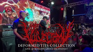 Vulvectomy quotDeformed Tits Collectionquot  Live  Bogota Grind Deathfest 2023 [upl. by Alta]