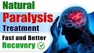 Natural Paralysis Treatment  Fast and Better Recovery  Brain Stroke Recovery  Dr Puru Dhawan [upl. by Milton]