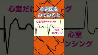 心電図検定‼️ペースメーカも出るんです！ 心電図検定 心電図 看護師 医学生 [upl. by Kreit200]