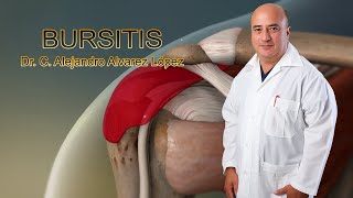 Bursitis Consejos Útiles y Tratamiento [upl. by Neivad968]