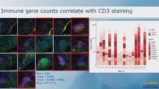 Discover RNA Biomarkers for Early Diagnosis and Prognosis of Melanoma [upl. by Aimaj]