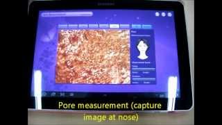 skin analysis application using MSS wireless scope skin scalp or hair analysis [upl. by Onurb]