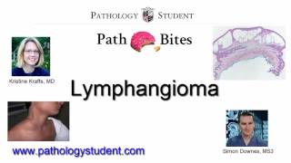 Path Bites  Lymphangiomas [upl. by Nomaid561]