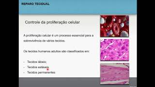 Reparo tecidual  Patologia geral 15 [upl. by Myrtia]