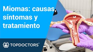 Miomas causas síntomas y tratamiento [upl. by Aime]