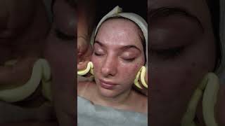 Esthetician 🧘‍♀️ Skin Care ASMR BLOOPERS 🤣 estheticianlife skincareasmr skincaretips [upl. by Ertemed]