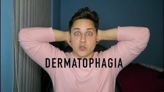 Living with Dermatophagia Skin biting disorder [upl. by Teeniv]