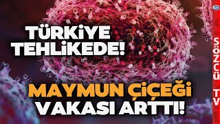 Korona Sonrası Maymun Çiçeği Virüsü Alarmı Acil Durum İlan Edildi Türkiyeyi Bekleyen Tehlike [upl. by Angela936]