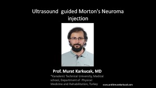 Ultrasound guided Mortons Neuroma injection 2 [upl. by Eceeryt891]