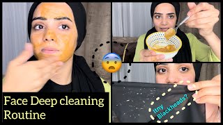 This Is How I Remove My Blackheads On Face  💯 Live Results Dietitian Aqsa [upl. by Porte]