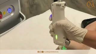 Séance dépilation laser à la Clinique Médicis Paris [upl. by Suelo630]