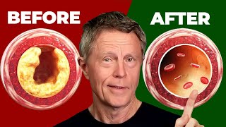 1 BEST Meal That Cleans Arteries [upl. by Ateloj]