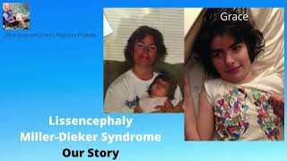 Lissencephaly and Grace Our Story [upl. by Alaek]