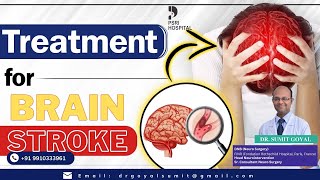 Treatments for Brain Stroke by Dr Sumit Goyal brain treatment neurology neurologist delhi [upl. by Ellata]