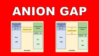 Anion Gap Explained ABG Part  2  Normal and High Anion Gap Metabolic Acidosis simplified [upl. by Almat]