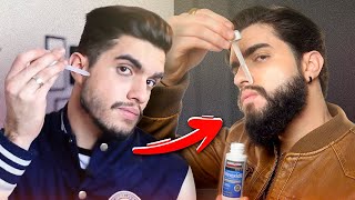 Como usar MINOXIDIL para crescer BARBA 🧔🏻‍♂️ [upl. by Lais]