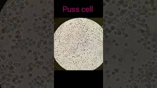 Urine slide under microscope With different cells  urine dmlt lab labtechnician rbc doctor [upl. by Asamot]