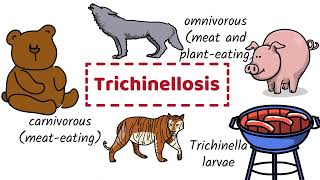 Trichinosis  Causes Symptoms Diagnosis Prevention [upl. by Erie885]