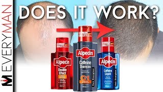 DOES CAFFEINE SHAMPOO WORK  Alpecin REVIEW amp Hair Growth Alternatives [upl. by Maiga775]