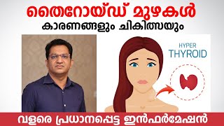 തൈറോയ്ഡ് മുഴകൾ കാരണങ്ങളും ചികിത്സയും  Thyroid Malayalam  Goiter [upl. by Aicac]