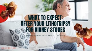 What to expect after your Lithotripsy procedure for Kidney Stones 2020  ESWL  Shockwave Therapy [upl. by Newmark]