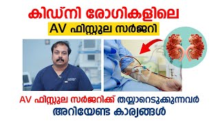 കിഡ്‌നി രോഗികളിലെ AV ഫിസ്റ്റുല സർജറി  Dr Vineeth Kumar  Best AV Fistula surgeon Kerala [upl. by Danny]