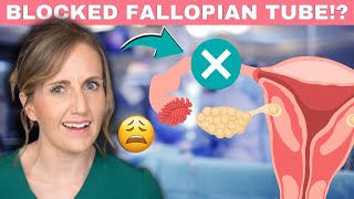 What can cause blocked fallopian tubes [upl. by Nyllaf963]