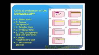 Longitudinal Melanonychia  LECTURE SEGMENT ONLY  Chris Adigun MD DERMfoot 2016 [upl. by Courtland]