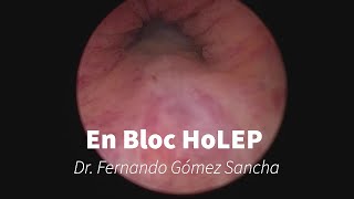 En Bloc HoLEP with early apical liberation [upl. by Selry]